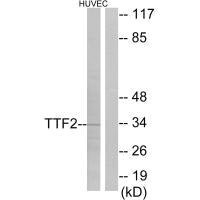 Western blot analysis of extracts from HUVEC cells, using TTF2 antibody.