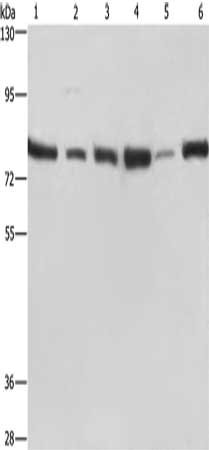Gel: 6%SDS-PAGE, Lysate: 40 ug, Lane 1-6: Jurkat cells, 293T cells, Hela cells, K562 cells, human testis tissue, A549 cells, Primary antibody: CSB-PA252235(SIRT1 Antibody) at dilution 1/500, Secondary antibody: Goat anti rabbit IgG at 1/8000 dilut...