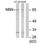 Western blot analysis of extracts from HT-29 cells and A549 cells, using NBN antibody.