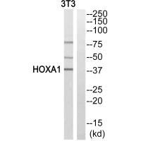 Western blot analysis of extracts from COLO cells, HeLa/ cells and 293 cells, using HOXA1 antibody.
