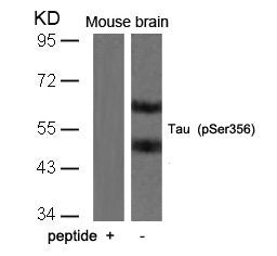 Western blot analysis of extracts from mouse brain tissue using Tau(Phospho-Ser356) Antibody and the same antibody preincubated with blocking peptide.