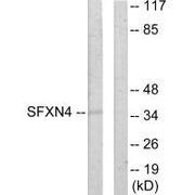 Western blot analysis of extracts from HUVEC cells, using SFXN4 antibody.