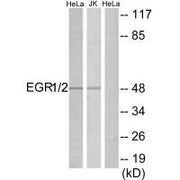 Western blot analysis of extracts from HeLa/Jurkat cells, using EGR1/2 antibody.