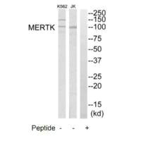 Western blot analysis of extracts from K562 cells and Jurkat cells, using MERTK antibody.