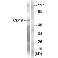 Western blot analysis of extracts from COS7 cells, treated with Serum (10%, 30mins), using CD19 (Ab-531) antibody.