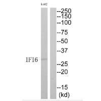 Western blot analysis of extracts from K562 cells, using IFI6 antibody.