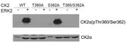 Western blot of CK2a(Phospho- Thr360/Ser362) antibody and CK2a antibody in vitro kinase assay. Both purified ERK2 and CK2 were used. CK2a(Phospho-Thr360/Ser362) antibody could recognize ERK2 phosphorylated wild type CK2a and CK2a when Ser362 was m...