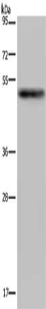 Gel: 8%SDS-PAGE, Lysate: 40 ug, Lane: Human hepatocellular carcinoma tissue, Primary antibody: CSB-PA254680(PKMYT1 Antibody) at dilution 1/200, Secondary antibody: Goat anti rabbit IgG at 1/8000 dilution, Exposure time: 5 minutes