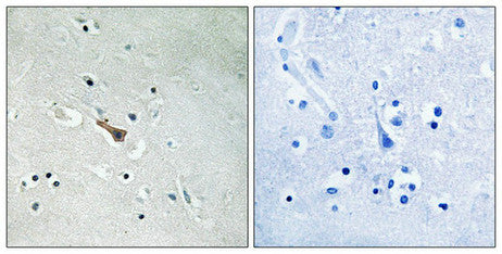 Immunohistochemical analysis of paraffin-embedded human brain tissue using APLP2 (Phospho-Tyr755) antibody (left)or the same antibody preincubated with blocking peptide (right).