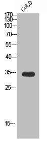 Western blot analysis of CoLo using TCEAL6 antibody.. Secondary antibody was diluted at 1:20000