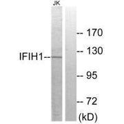 Western blot analysis of extracts from Jurkat cells, using IFIH1 antibody.