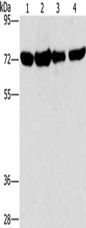 Gel: 6%SDS-PAGE, Lysate: 40 ug, Lane 1-4: A172 cells, hela cells, hepg2 cells, 293T cells, Primary antibody: CSB-PA255561(DEPDC1 Antibody) at dilution 1/150, Secondary antibody: Goat anti rabbit IgG at 1/8000 dilution, Exposure time: 1 minute