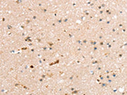 The image on the left is immunohistochemistry of paraffin-embedded Human brain tissue using CSB-PA255835(RASGEF1A Antibody) at dilution 1/20, on the right is treated with fusion protein. (Original magnification: ×200)