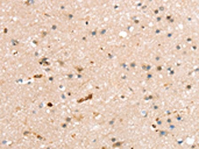 The image on the left is immunohistochemistry of paraffin-embedded Human brain tissue using CSB-PA255835(RASGEF1A Antibody) at dilution 1/20, on the right is treated with fusion protein. (Original magnification: ×200)