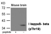 Western blot analysis of extracts from Mouse brain tissue using IkappaB- beta (Phospho-Thr19) Antibody.The lane on the left is treated with the antigen-specific peptide.