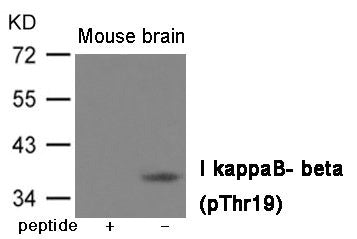 Western blot analysis of extracts from Mouse brain tissue using IkappaB- beta (Phospho-Thr19) Antibody.The lane on the left is treated with the antigen-specific peptide.