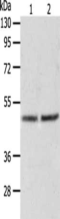 Gel: 10%SDS-PAGE, Lysate: 40 ug, Lane 1-2: Human fetal liver tissue, hepg2 cells, Primary antibody: CSB-PA256331(AGXT Antibody) at dilution 1/1050, Secondary antibody: Goat anti rabbit IgG at 1/8000 dilution, Exposure time: 2 minutes