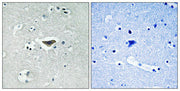 Immunohistochemical analysis of paraffin-embedded human brain tissue using Ras-GRF1 (Phospho-Ser916) antibody (left)or the same antibody preincubated with blocking peptide (right).