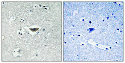 Immunohistochemical analysis of paraffin-embedded human brain tissue using Ras-GRF1 (Phospho-Ser916) antibody (left)or the same antibody preincubated with blocking peptide (right).