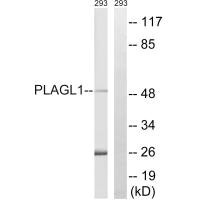 Western blot analysis of extracts from 293 cells, using PLAGL1 antibody.