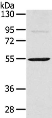 Gel: 8%SDS-PAGE, Lysate: 40 ug, Lane: Mouse heart tissue, Primary antibody: CSB-PA256881(SESN3 Antibody) at dilution 1/200 dilution, Secondary antibody: Goat anti rabbit IgG at 1/8000 dilution, Exposure time: 10 seconds