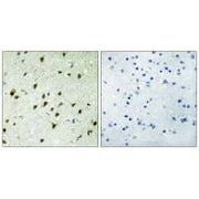 Immunohistochemistry analysis of paraffin-embedded human brain tissue, using MAD4 antibody.