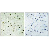 Immunohistochemistry analysis of paraffin-embedded human brain tissue, using MAD4 antibody.
