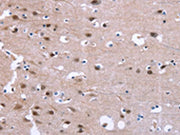 The image on the left is immunohistochemistry of paraffin-embedded Human brain tissue using CSB-PA257590(GPR171 Antibody) at dilution 1/25, on the right is treated with synthetic peptide. (Original magnification: ×200)