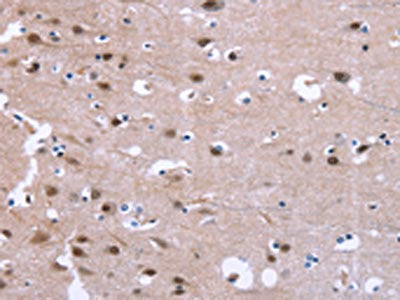 The image on the left is immunohistochemistry of paraffin-embedded Human brain tissue using CSB-PA257590(GPR171 Antibody) at dilution 1/25, on the right is treated with synthetic peptide. (Original magnification: ×200)