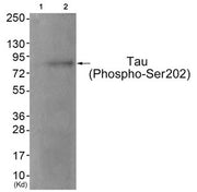 Western blot analysis of extracts from JK cells (Lane 2), using Tau (Phospho-Ser202) Antibody. The lane on the left is treated with antigen-specific peptide.