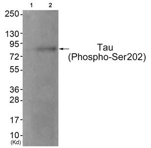 Western blot analysis of extracts from JK cells (Lane 2), using Tau (Phospho-Ser202) Antibody. The lane on the left is treated with antigen-specific peptide.