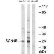 Western blot analysis of extracts from HepG2 cells and Jurkat cells, using SCN4B antibody.