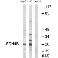 Western blot analysis of extracts from HepG2 cells and Jurkat cells, using SCN4B antibody.