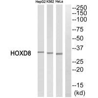 Western blot analysis of extracts from HepG2 cells, K562 cells and HeLa cells, using HOXD8 antibody.