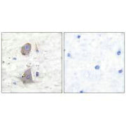 Immunohistochemical analysis of paraffin-embedded human brain tissue using GLUT1 antibody.