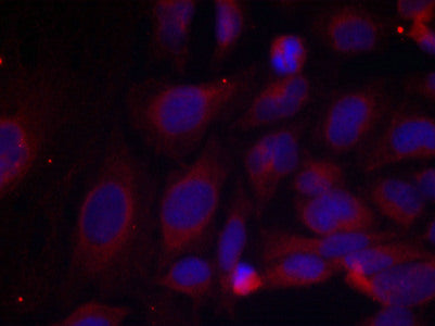 Immunofluorescence staining of methanol-fixed HeLa cells using NF-kappa;B p105 (phospho-Ser893) antibody.