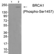 Western blot analysis of extracts from 293 cells (Lane 2), using BRCA1 (Phospho-Ser1457) Antibody. The lane on the left is treated with antigen-specific peptide.