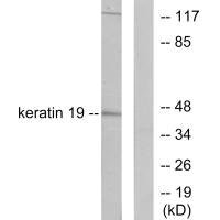 Western blot analysis of extracts from LOVO cells, using Keratin 19 antibody.
