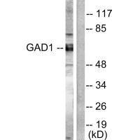 Western blot analysis of extracts from mouse brain cells, using GAD1/2 antibody.