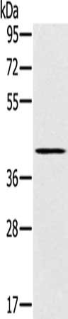Gel: 8%SDS-PAGE, Lysate: 40 ug, Lane: Mouse kidney tissue, Primary antibody: CSB-PA258920(SLC14A1 Antibody) at dilution 1/200, Secondary antibody: Goat anti rabbit IgG at 1/8000 dilution, Exposure time: 2 minutes