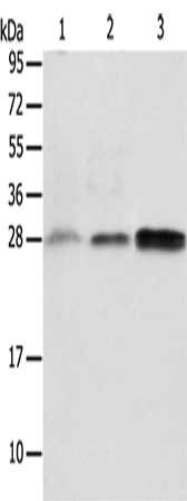 Gel: 12%SDS-PAGE, Lysate: 40 ug, Lane 1-3: Human fetal liver tissue, Human seminoma tissue, RAW264.7 cells, Primary antibody: CSB-PA259131(ALKBH2 Antibody) at dilution 1/650, Secondary antibody: Goat anti rabbit IgG at 1/8000 dilution, Exposure ti...