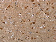 The image on the left is immunohistochemistry of paraffin-embedded Human brain tissue using CSB-PA259165(MARK1 Antibody) at dilution 1/30, on the right is treated with synthetic peptide. (Original magnification: ×200)