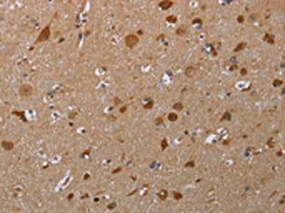 The image on the left is immunohistochemistry of paraffin-embedded Human brain tissue using CSB-PA259165(MARK1 Antibody) at dilution 1/30, on the right is treated with synthetic peptide. (Original magnification: ×200)