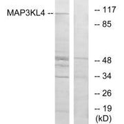 Western blot analysis of extracts from HT-29 cells, using MAP3KL4 antibody.