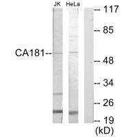 Western blot analysis of extracts from Jurkat cells and HeLa cells, using CA181 antibody.