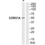 Western blot analysis of extracts from Jurkat cells, using CORO1A antibody.