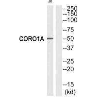 Western blot analysis of extracts from Jurkat cells, using CORO1A antibody.