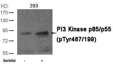 Western blot analysis of extracts from 293 cells untreated or treated with sorbitol using PI3 Kinase p85/p55 (phospho-Tyr467/199)Antibody.