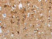 The image on the left is immunohistochemistry of paraffin-embedded Human brain tissue using CSB-PA260598(NEK5 Antibody) at dilution 1/25, on the right is treated with synthetic peptide. (Original magnification: ×200)