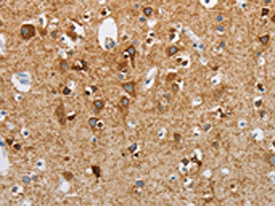 The image on the left is immunohistochemistry of paraffin-embedded Human brain tissue using CSB-PA260598(NEK5 Antibody) at dilution 1/25, on the right is treated with synthetic peptide. (Original magnification: ×200)